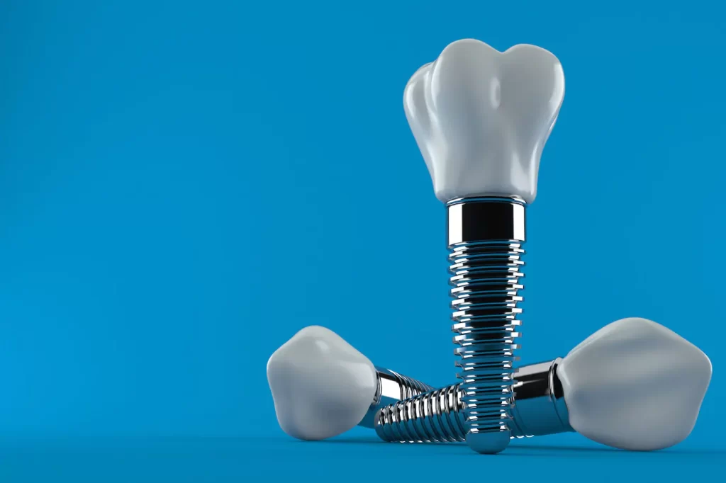 Dental-implant-harshana-Dental-care-dindigul