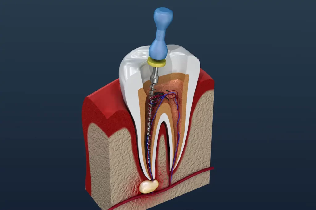 harshana-Dental-care-dindigul