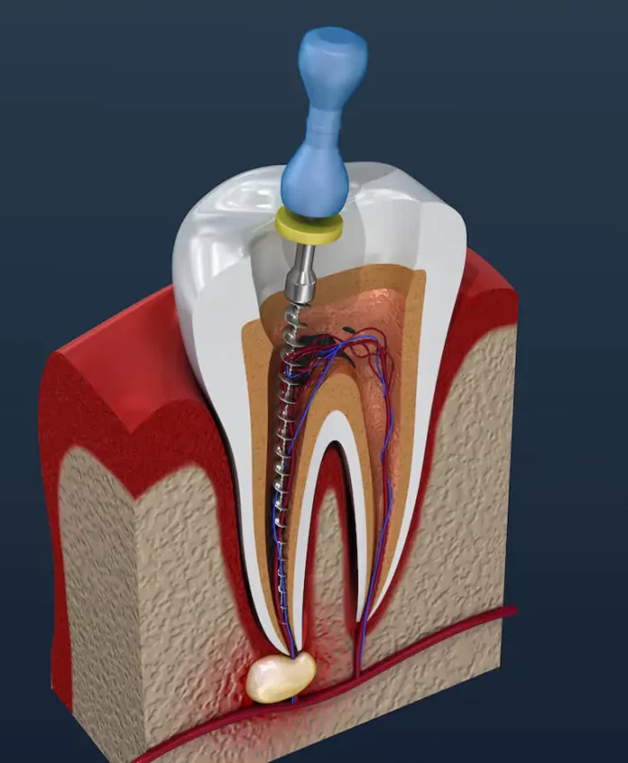 harshana-Dental-care-dindigul
